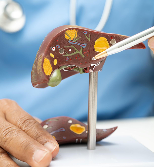 Chemotherapy Cost Factors